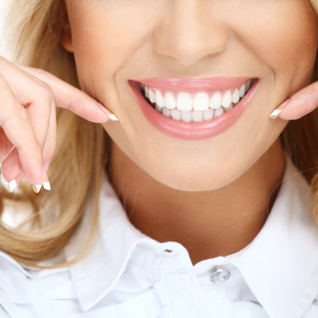 Odontología estética en dentista Sevilla Pino Montano